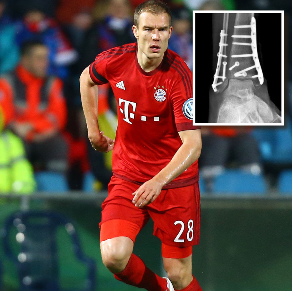 Badštuber slomio nogu!