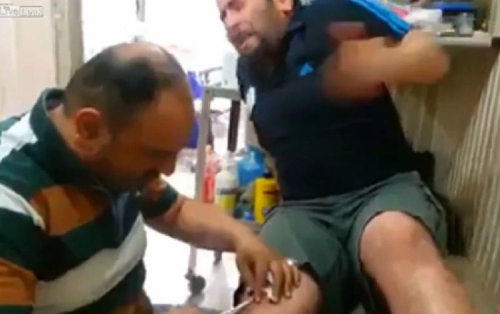 Doktor šamara pacijenta jer jauče tokom ušivanja! (VIDEO)