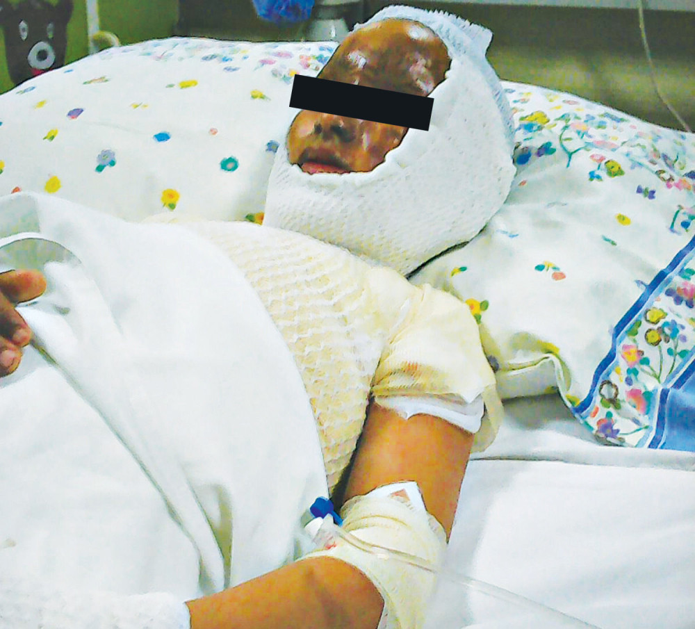 Narkoman pretvorio dete u živu buktinju