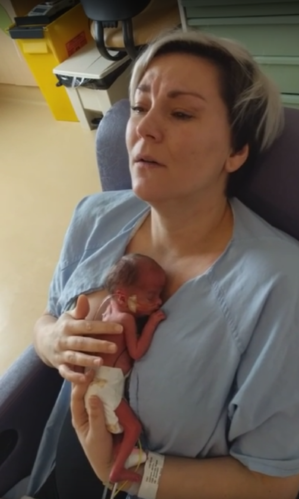 Prvi susret majke sa prevremeno rođenim sinom! (VIDEO)