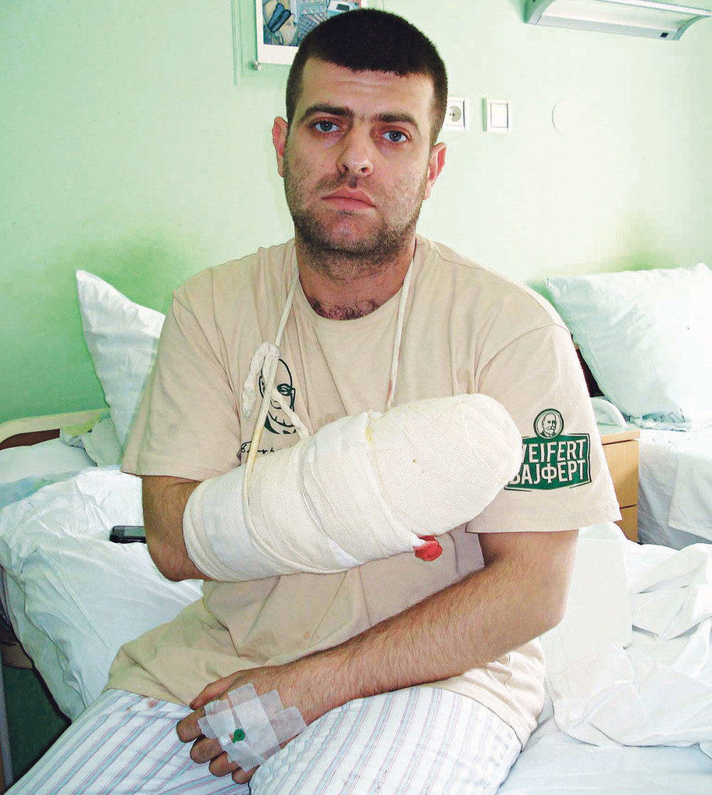 Mašina radniku smrskala šaku minut pre pauze