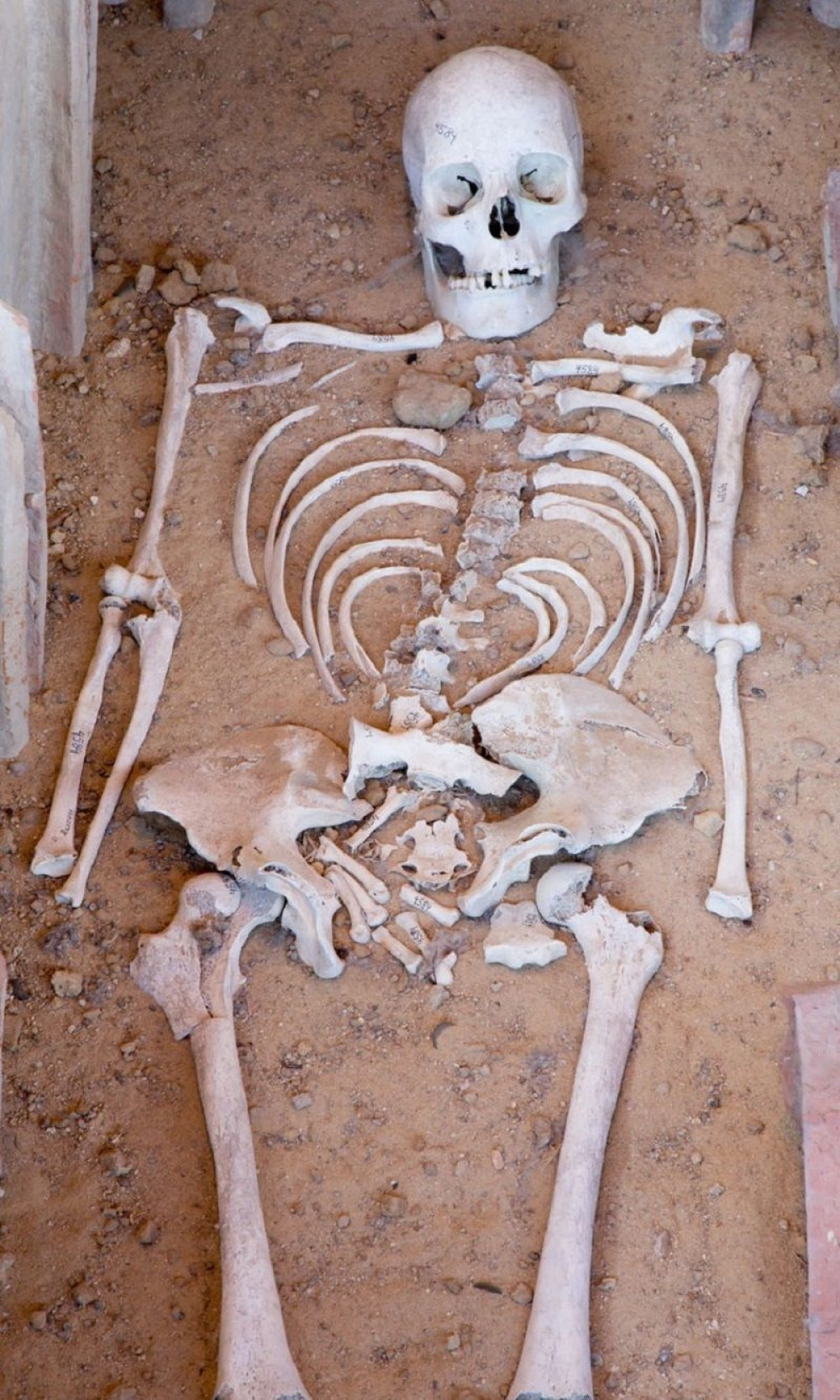 Popravljali kolovoz, pa iskopali kostur!