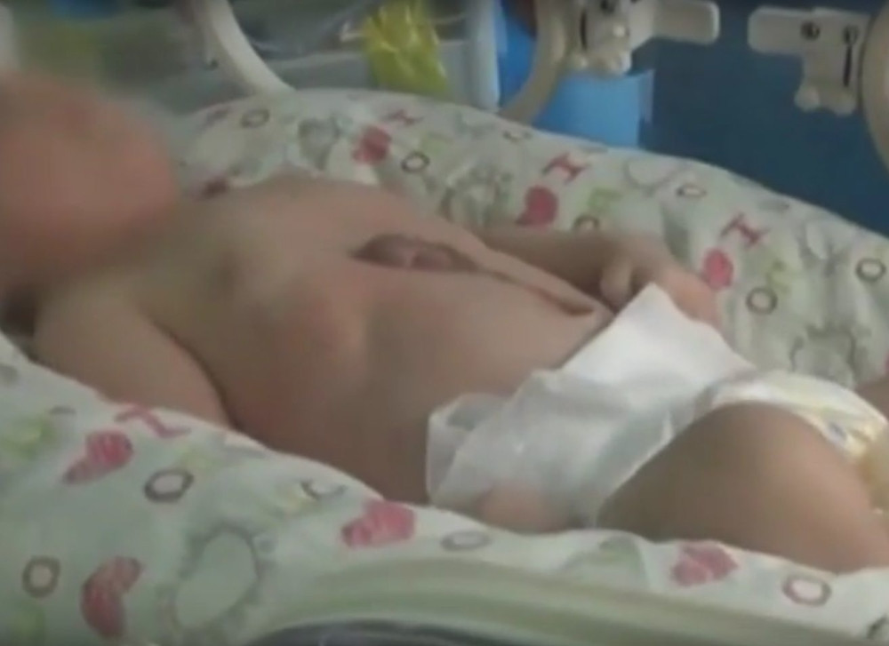 Bebi srce na površini tela (UZNEMIRUJUĆI VIDEO)