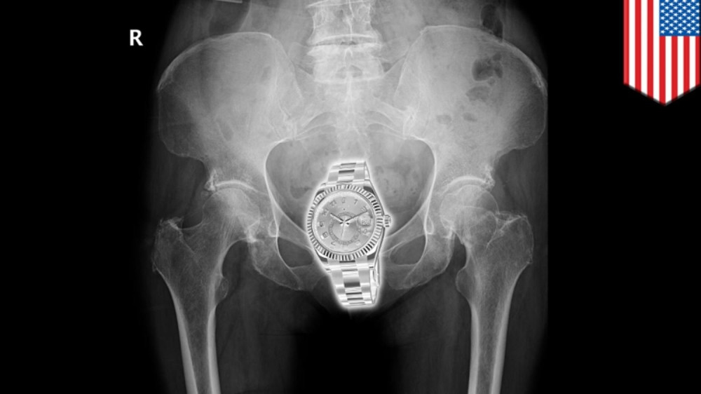 Evo šta su sve žene krile u vagini! (VIDEO)