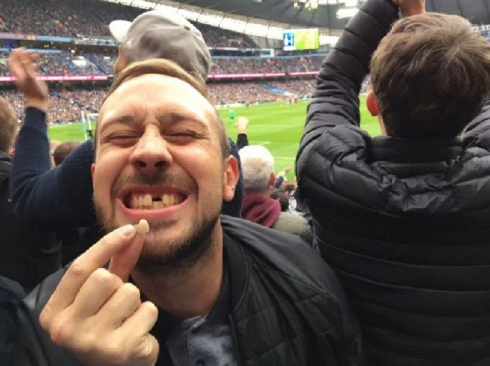 Navijaču ispao zub dok je proslavljao gol! (FOTO+VIDEO)