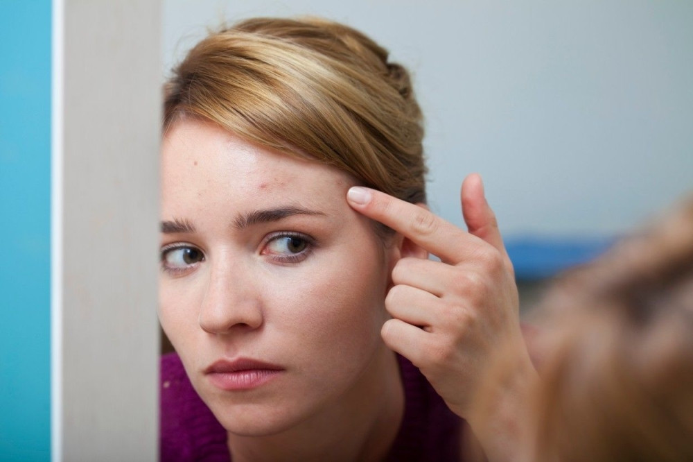 Rešite se ožiljaka od akni pomoću ove jeftine namirnice