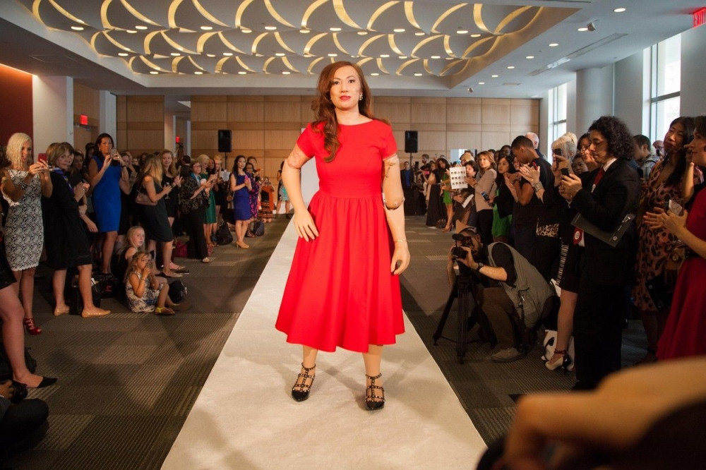 Manekenka bez ruku i nogu zvezda revije! (FOTO GELERIJA)