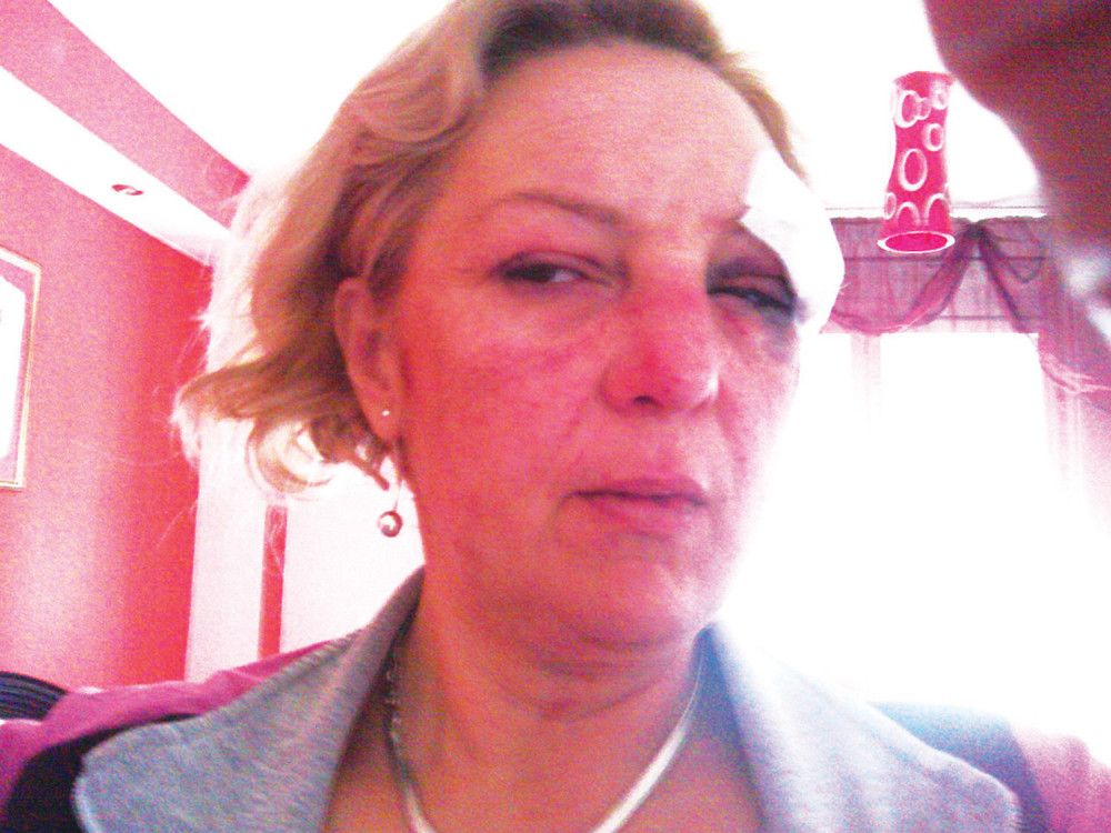 Odbila udvarača, on je brutalno pretukao!