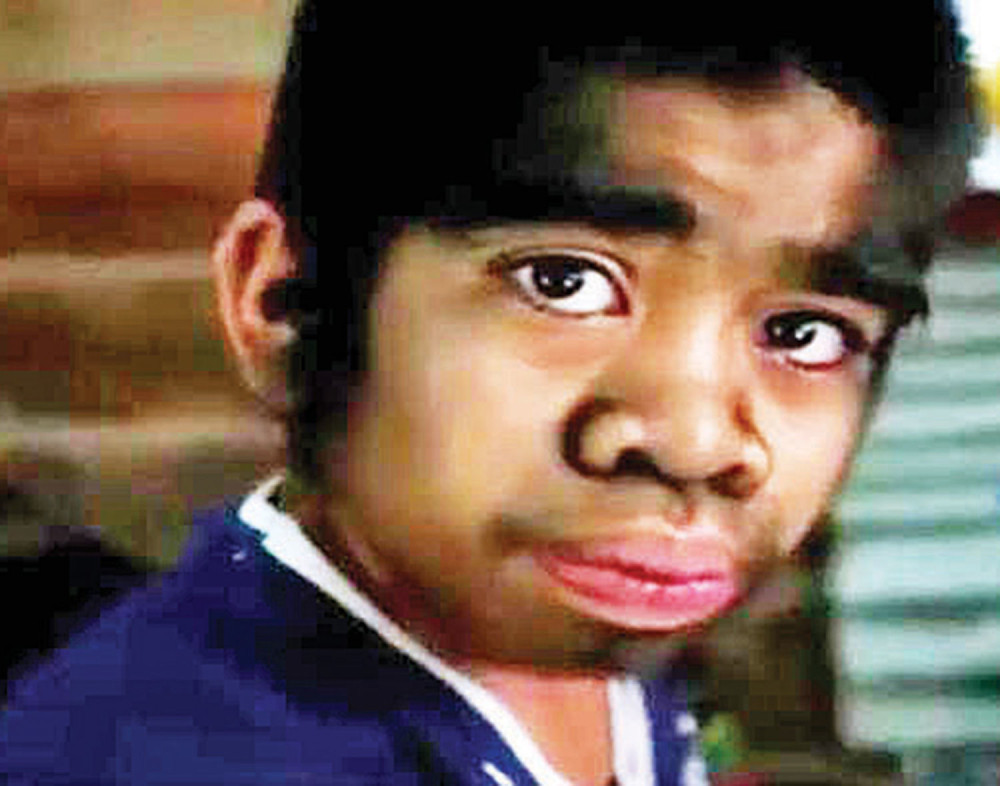 Dečaka „vukodlaka” obožavaju!