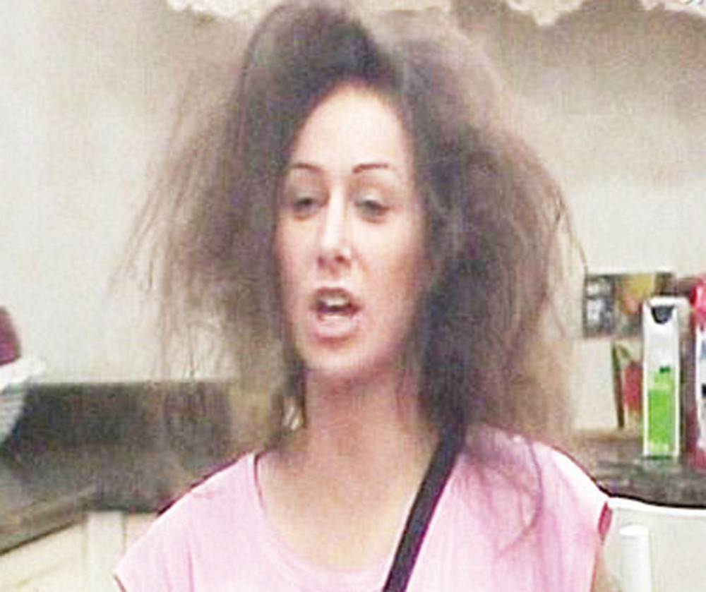 Macina frizura kao posledica strujnog udara