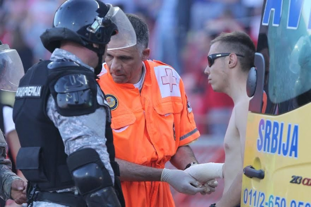 Navijač Zvezde izgubio dva prsta