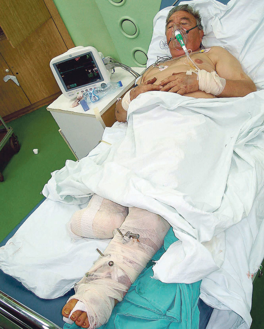 Penjala mi se uz nogu i uvlačila me u sečiva