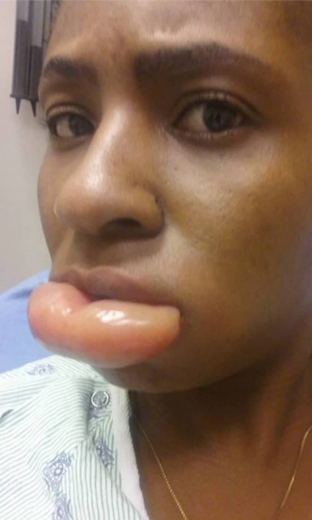 Stavila je karmin i desilo se ovo