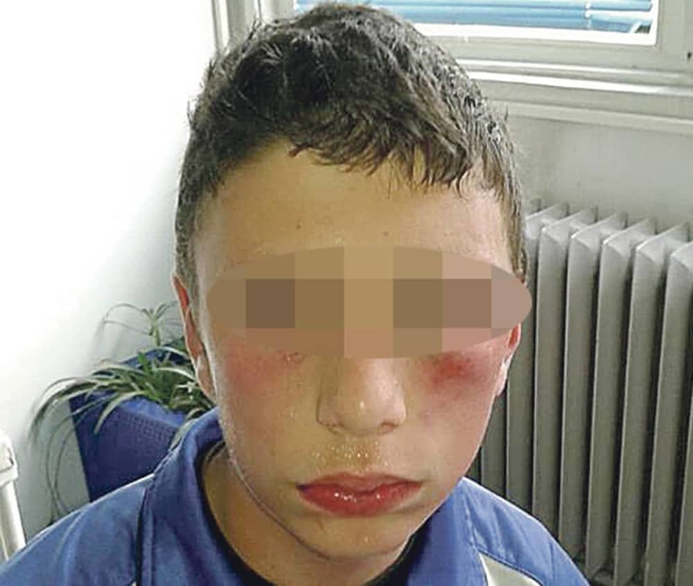 Pretukao bolesno dete zbog lopte