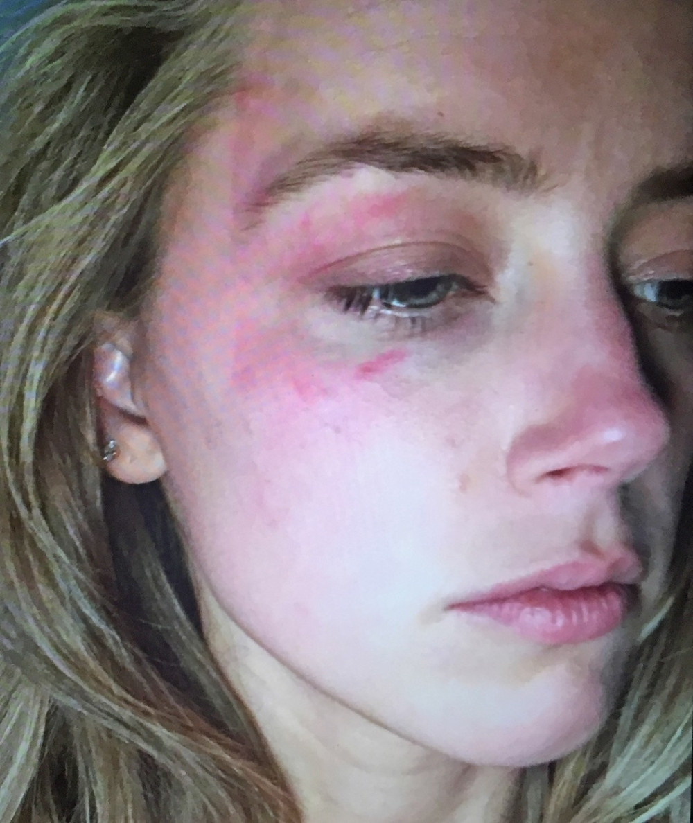 Džoni Dep prebio Amber Herd