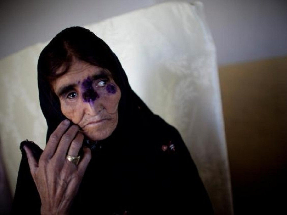 Širi se jeziva bolest (UZNEMIRUJUĆI VIDEO)