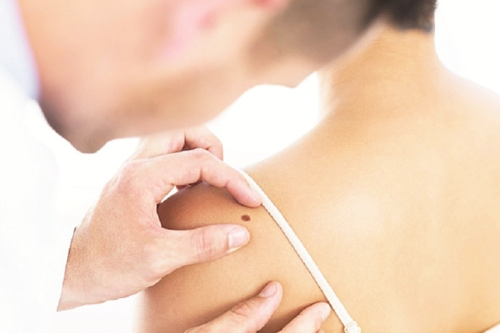 Evo kako da se pregledate!