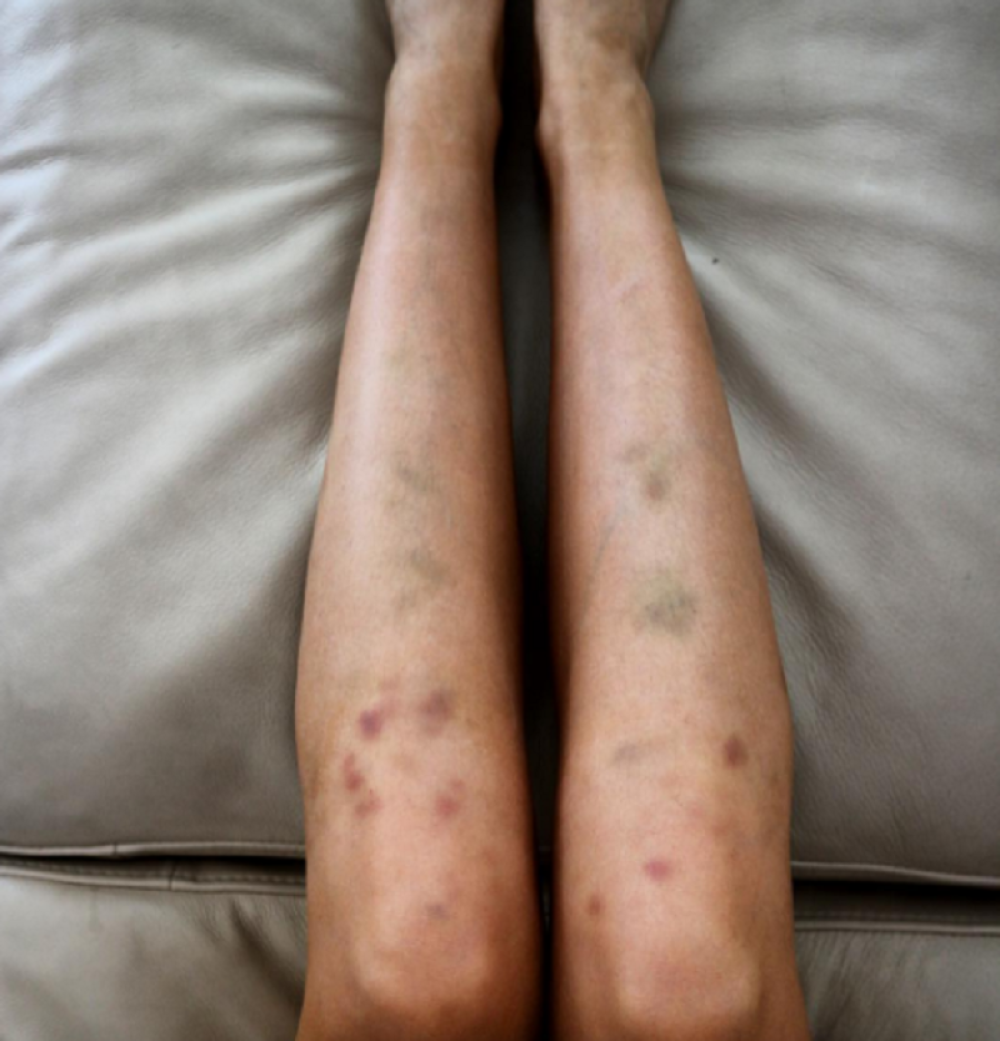 Pevačica uznemirila Instagram