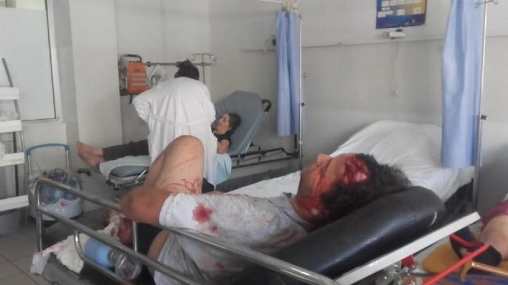 U nesreći povređeno sedam radnika