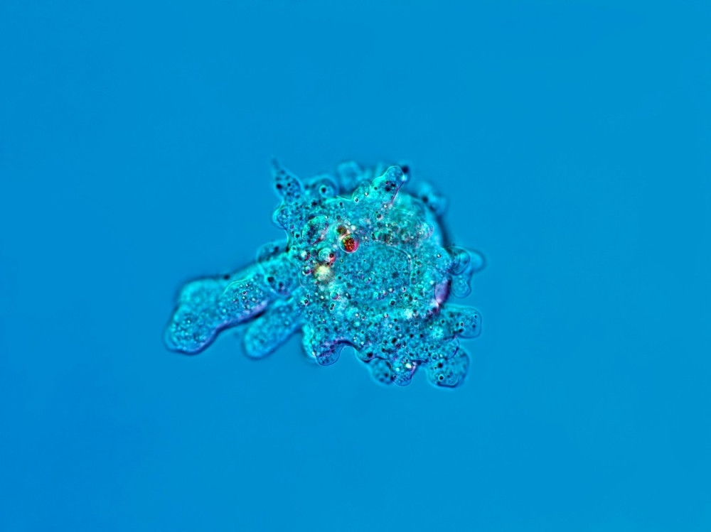 Ameba koja jede mozak ubila tinejdžerku!