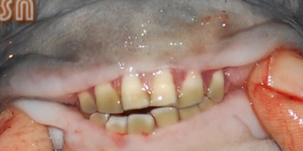 Riba sa ljudskim zubima otkida testise (VIDEO)