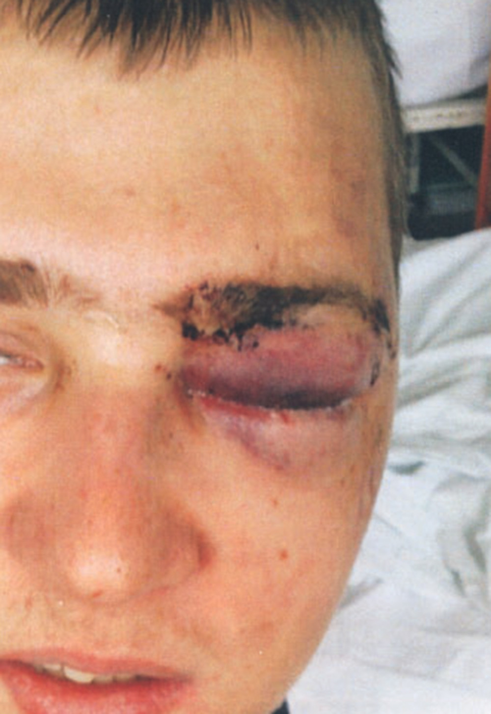 Sin čačanskog moćnika pretukao klince?!