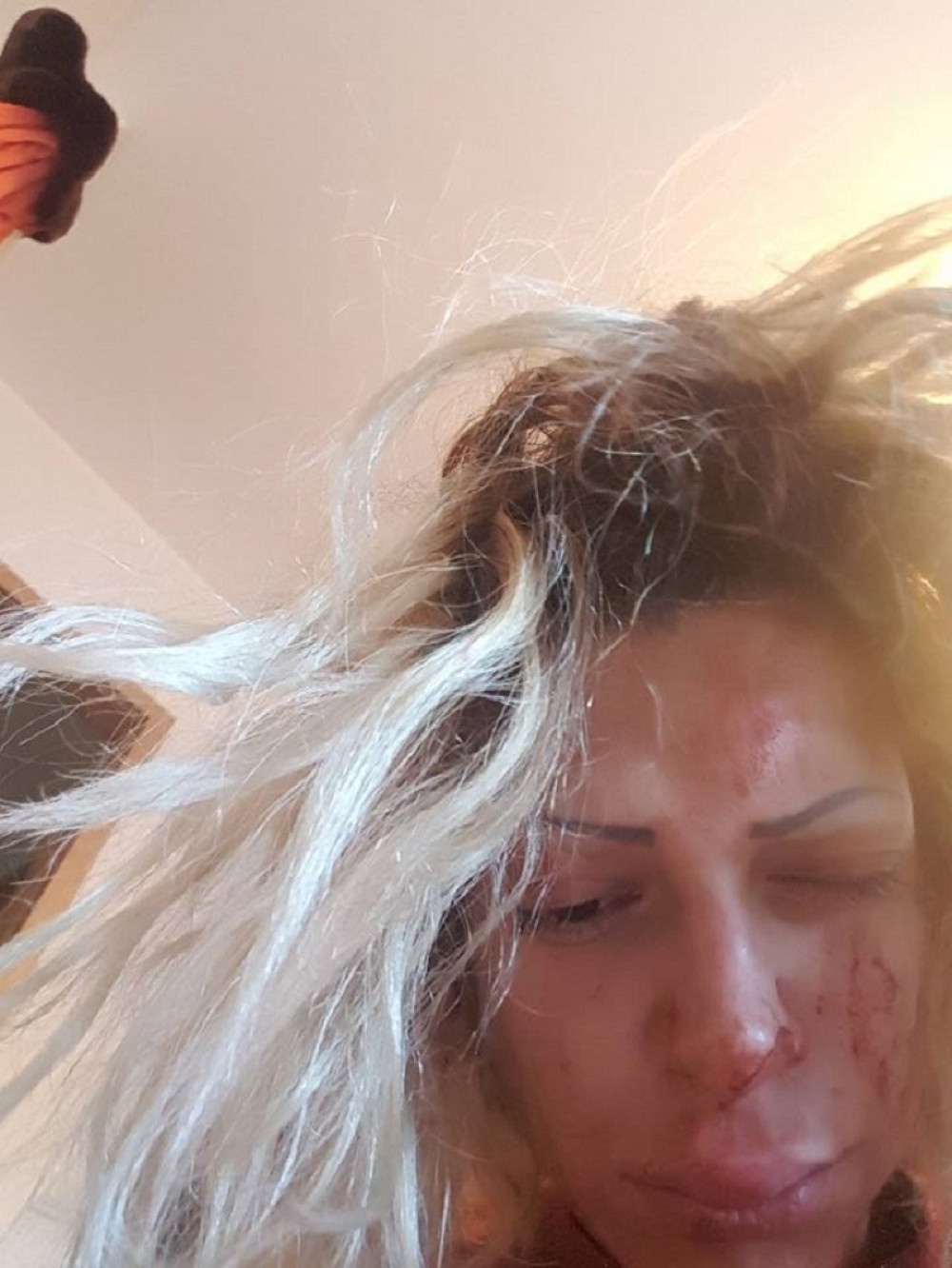 Pretučena pevačica Dunja Ilić u Prištini!