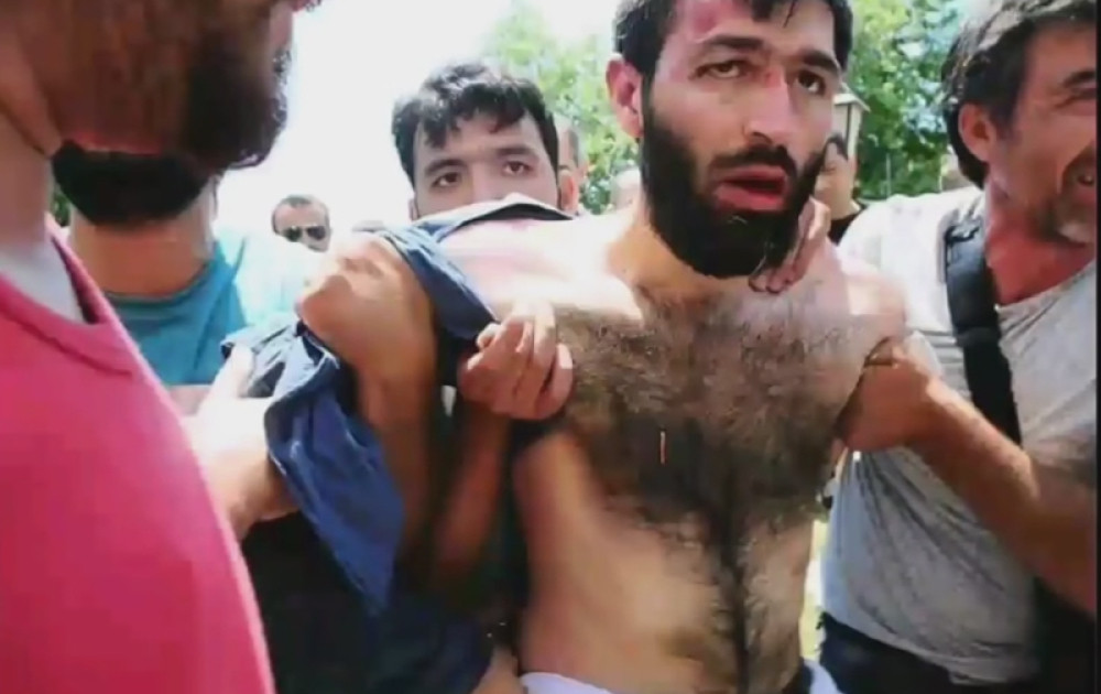 Vikao da će se razneti, pa dobio batine (VIDEO)