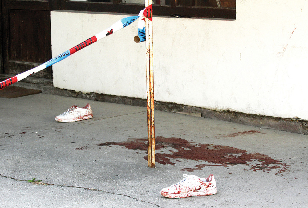 Žrtvi metak razorio pluća!