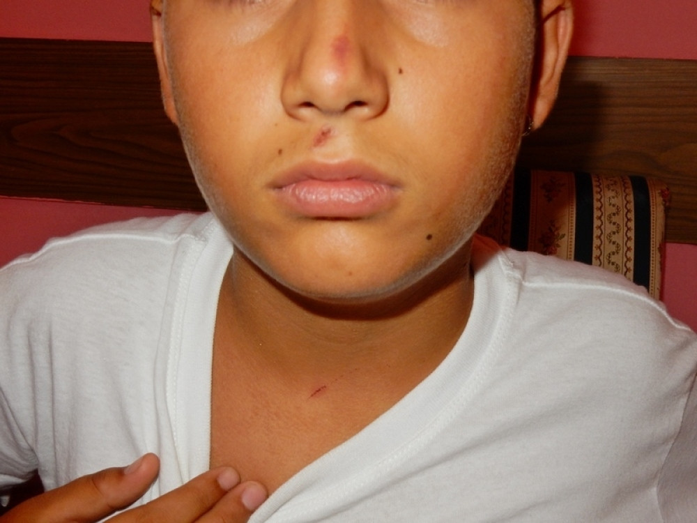 Policajac pretukao druga svog sina