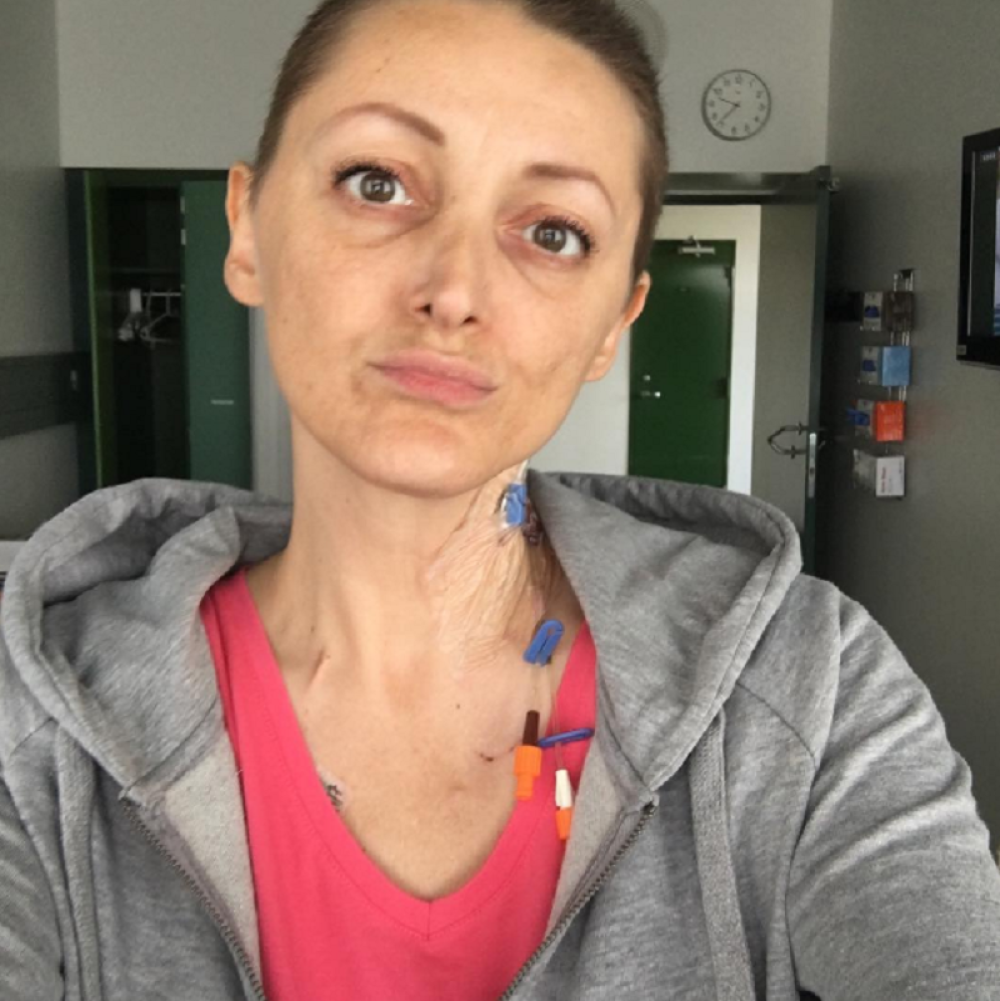 Ovo su simptomi bolesti od koje je umrla Dona Ares!