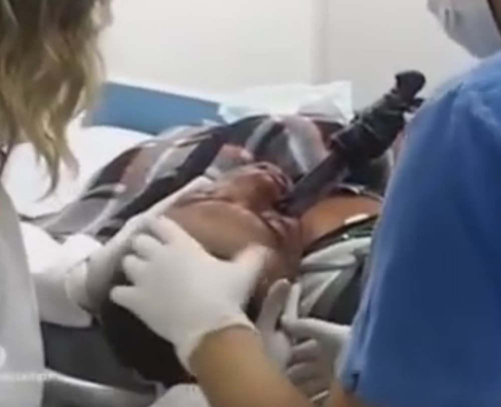 Nož mu se zario u lice (UZNEMIRUJUĆI VIDEO)