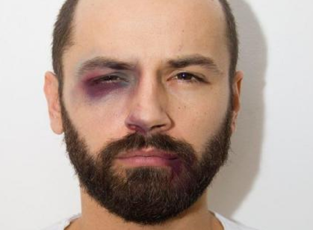 Prebijen učesnik "Maldiva"?