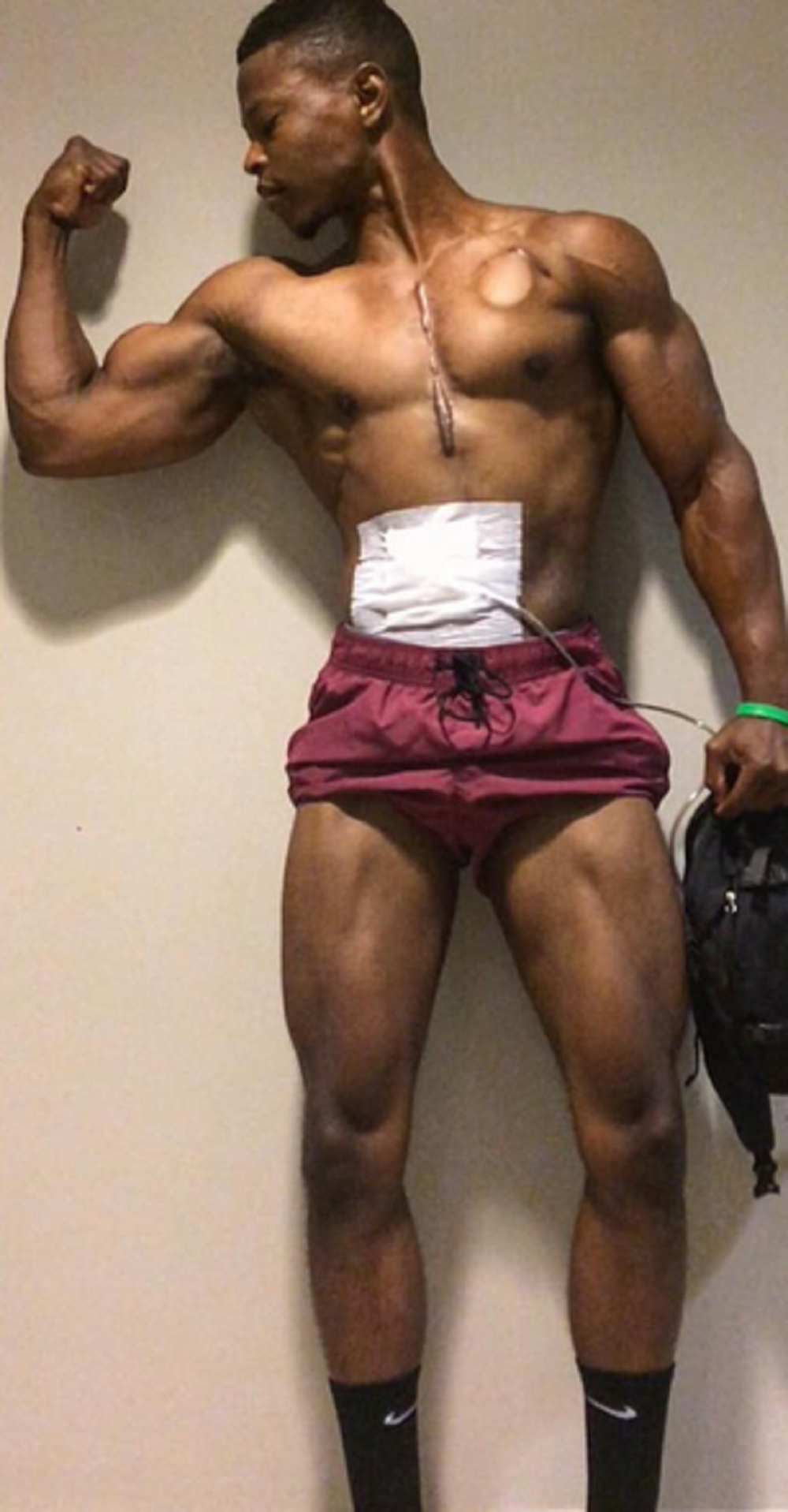 Ide u teretanu sa veštačkim srcem u rancu! (FOTO)