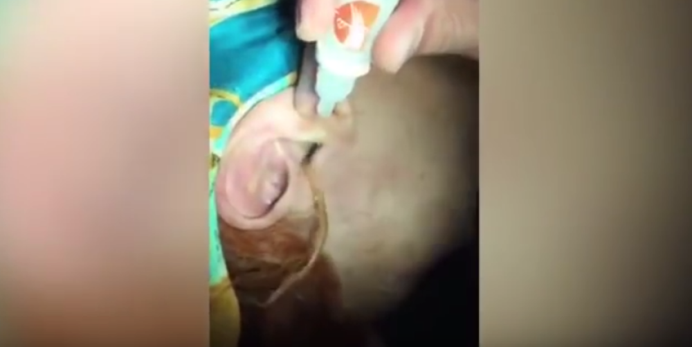 Ovaj užas je ženi izašao iz uveta (VIDEO)