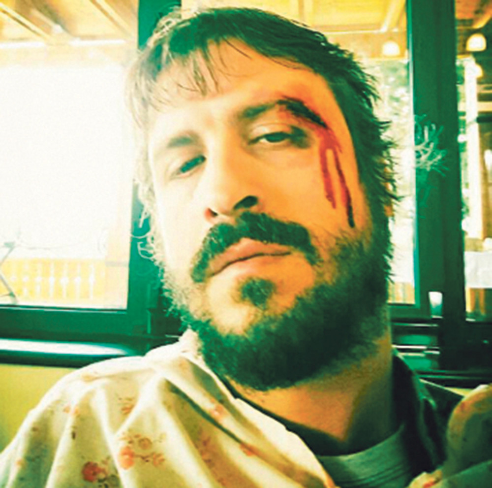 Banetu Trifunoviću razbili glavu