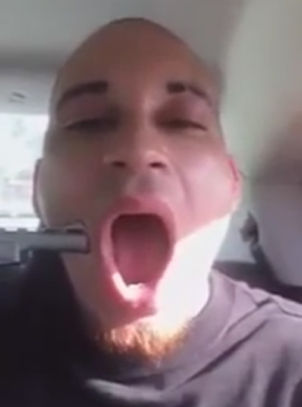 Upucao se u glavu radi zabave (UZNEMIRUJUĆI VIDEO)