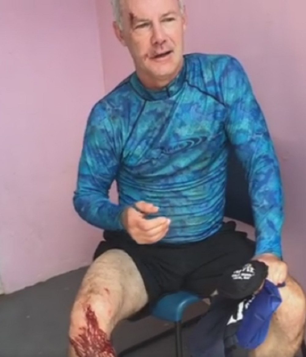 Ajkula ga ščepala za facu (UZNEMIRUJUĆI FOTO)