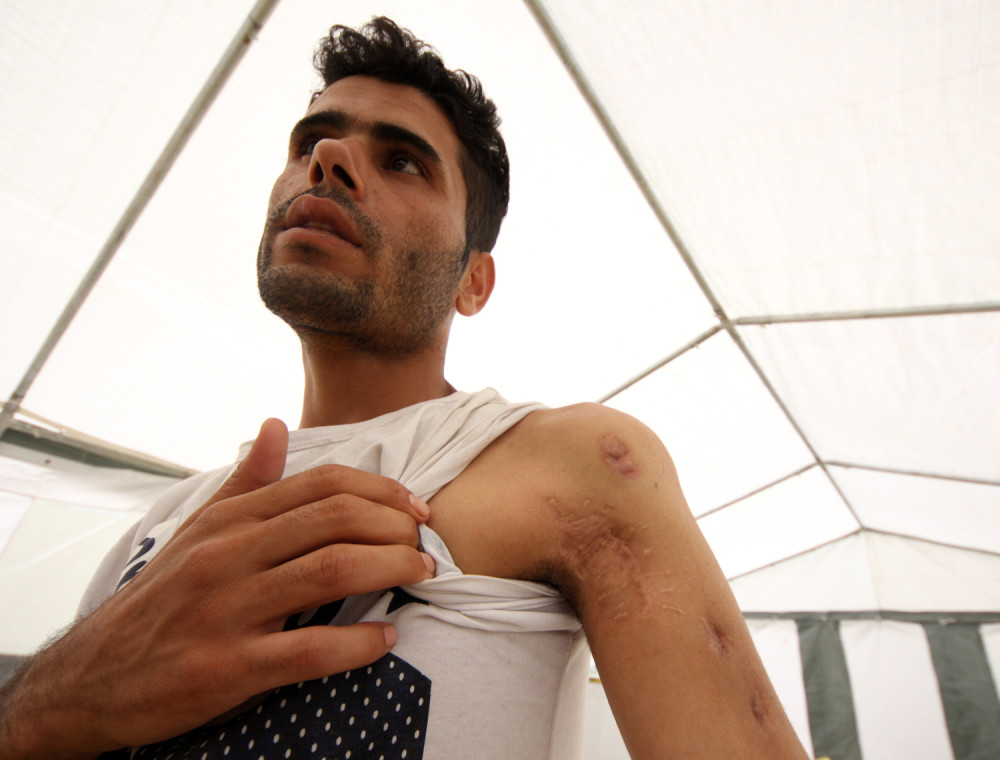 Iznemogli migranti i dalje u štrjaku