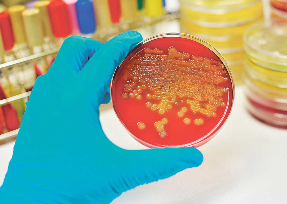 Prvi slučaj gonoreje otporne na sve antibiotike!