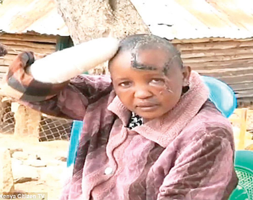 Odsekao joj šake “jer nije mogla da zatrudni”?!