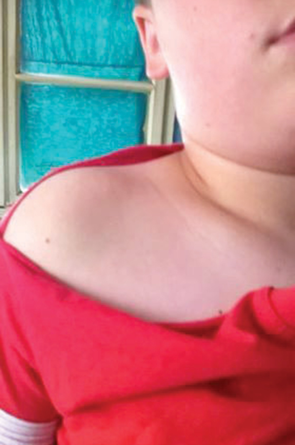 Detetu pocepali dres i pretukli oca