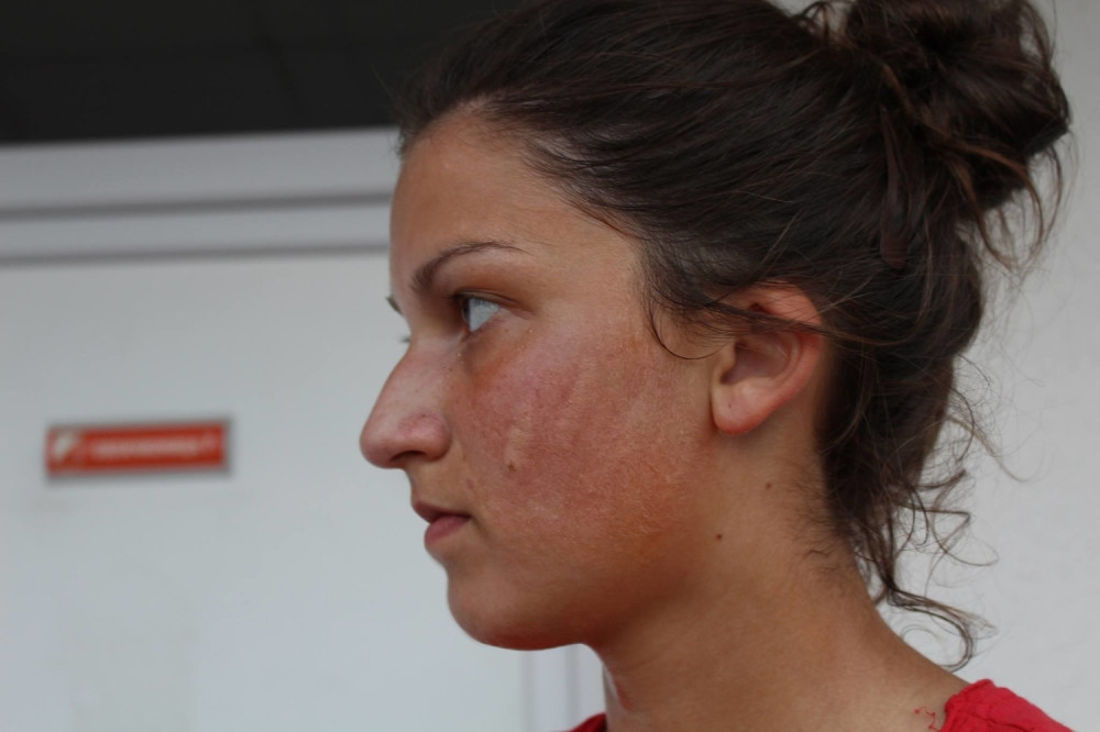 Funkcioner šamarao fudbalerku jer je slavila pobedu?!