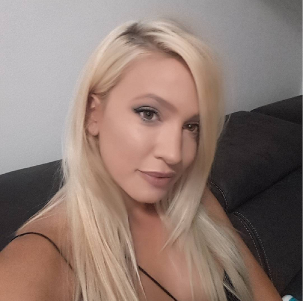 U Milice duge dlačice! (FOTO)