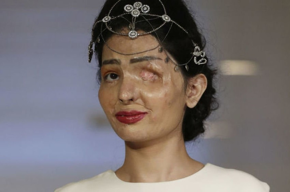 Žrtva napada kiselinom - manekenka na Nedelji mode (VIDEO)