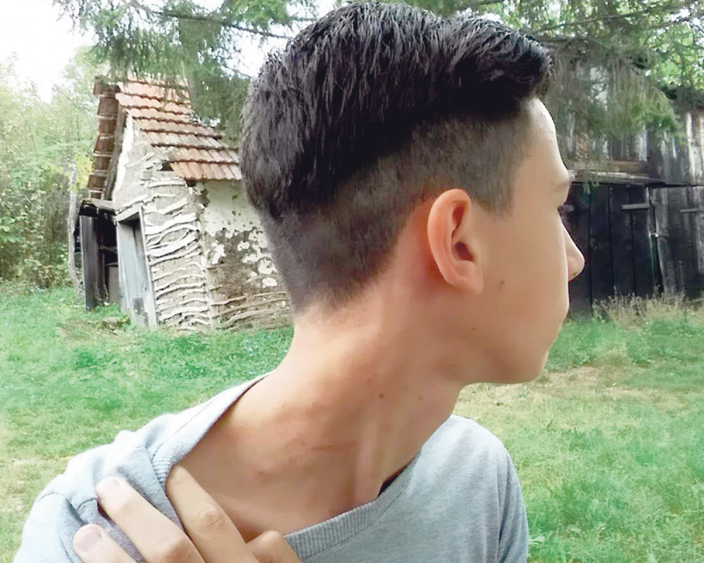 Umalo ugušio dečaka zbog kruške!