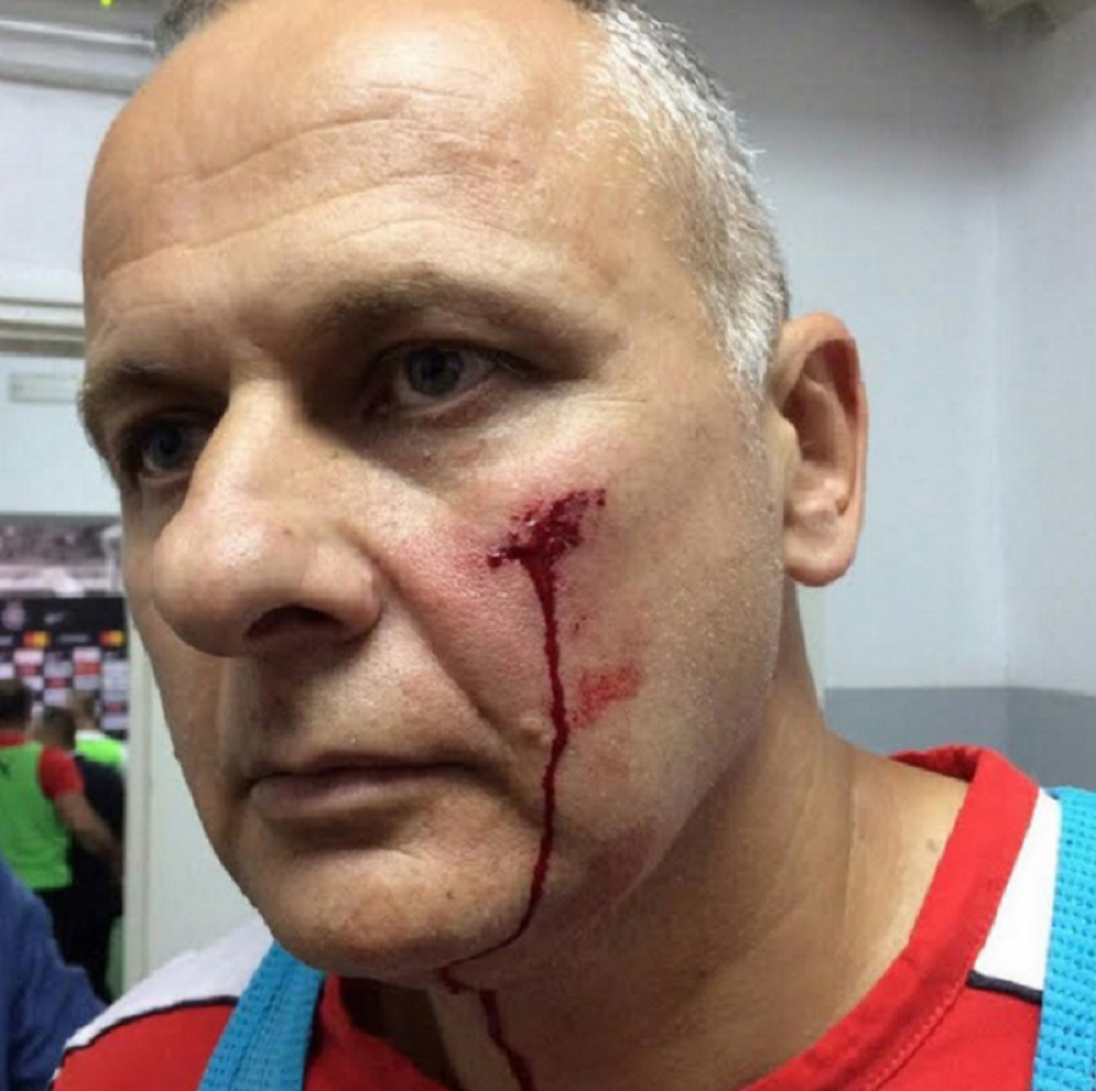 Božovićev pomoćnik dobio kamen u glavu!