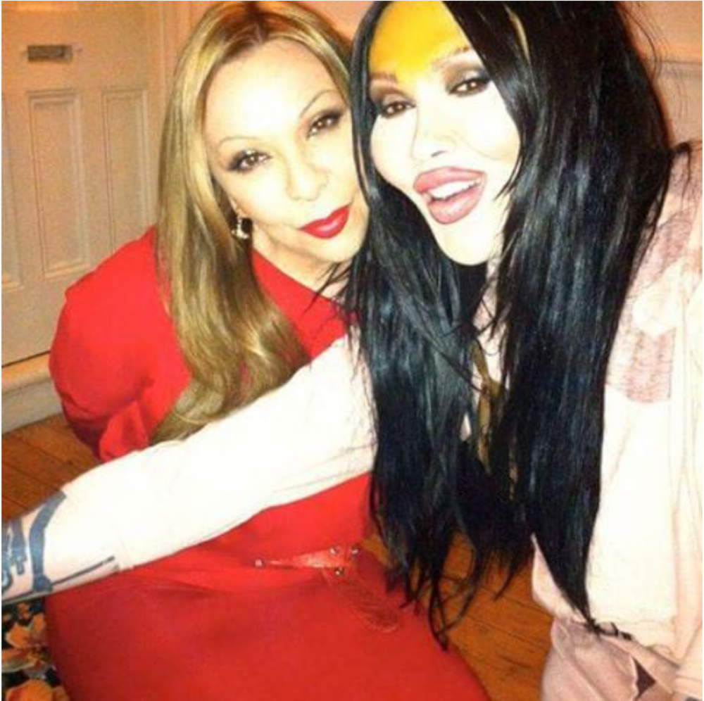 Najveći promašaji estetske hirurgije u svetu poznatih