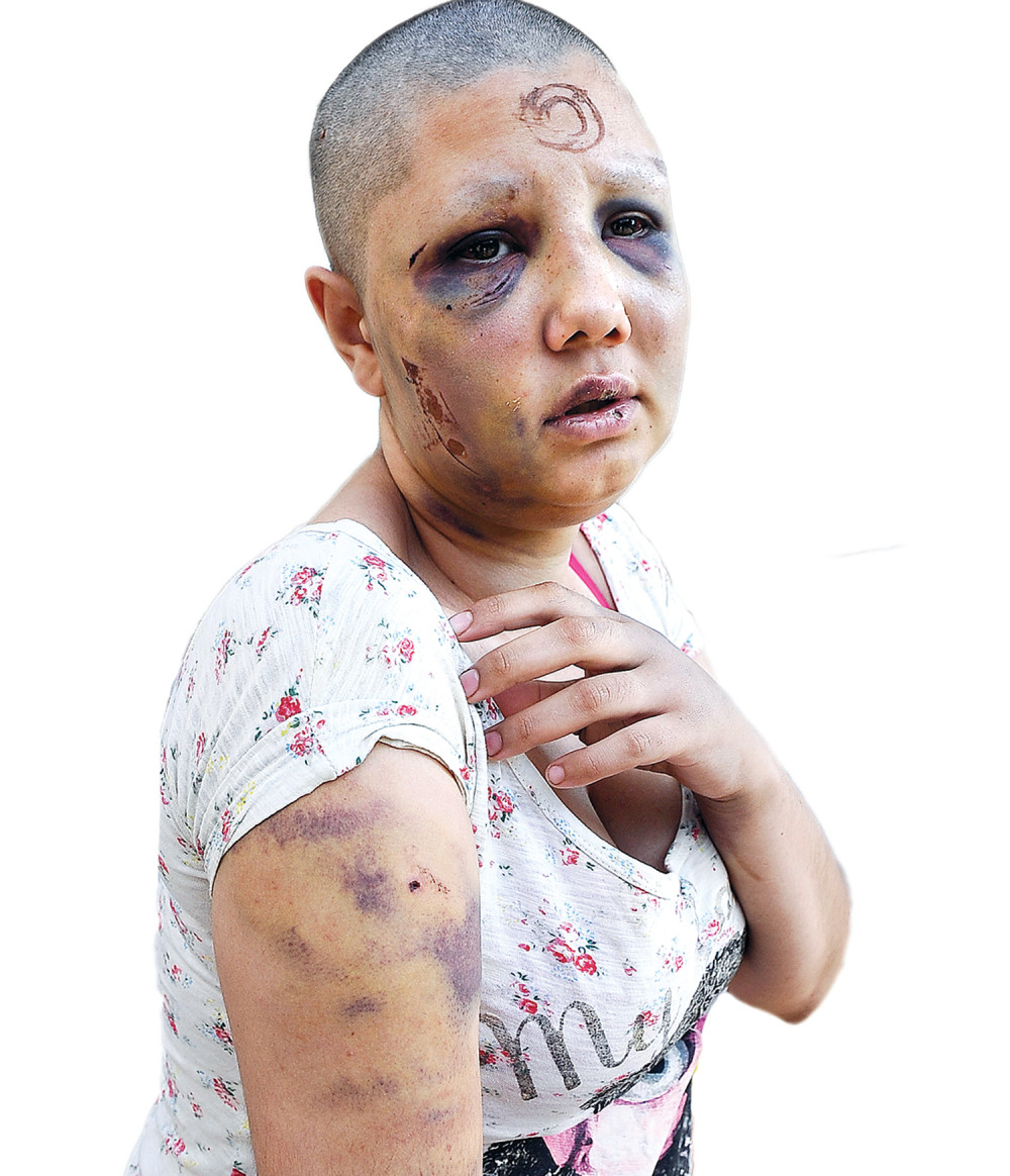 Manijak: Samo sam joj lupio nekoliko šamara!