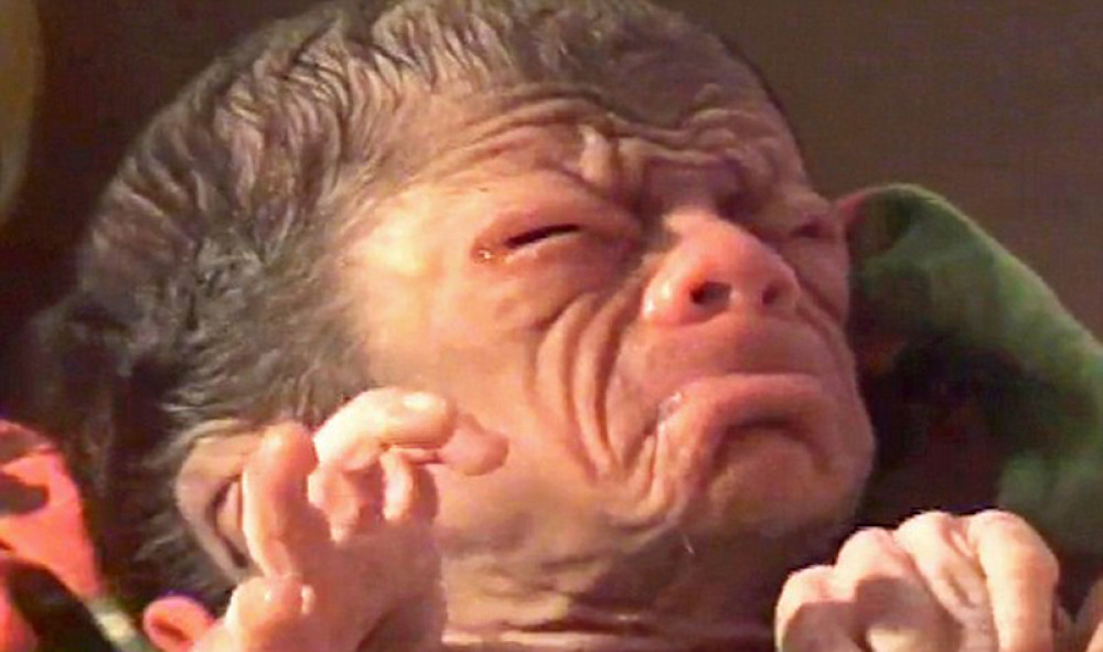 Tek rođena beba izgleda kao starac (VIDEO)